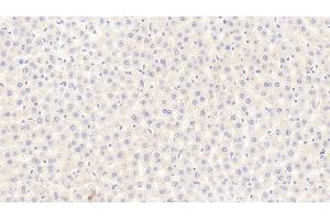 Detection of FGF21 in Rat Liver Tissue using Polyclonal Antibody to Fibroblast Growth Factor 21 (FGF21) (FGF21 antibody  (AA 25-208))