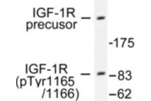 Image no. 1 for anti-Insulin-Like Growth Factor 1 Receptor (IGF1R) (pTyr1165), (pTyr1166) antibody (ABIN318046) (IGF1R antibody  (pTyr1165, pTyr1166))