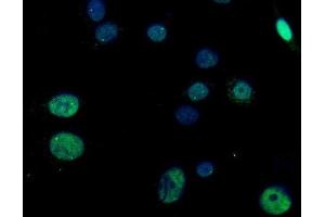 anti-Regulator of G-Protein Signalling 12 (RGS12) (AA 746-995) antibody