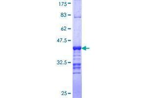 Image no. 1 for Sarcoma Antigen 1 (SAGE1) (AA 357-455) protein (GST tag) (ABIN1319119) (SAGE1 Protein (AA 357-455) (GST tag))