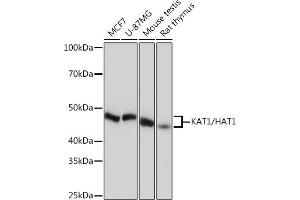 Western blot analysis of extracts of various cell lines, using K/H Rabbit mAb (ABIN7267702) at 1:1000 dilution. (HAT1 antibody)