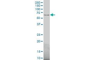 ACVR2B polyclonal antibody (A01), Lot # 060717JCS1 Western Blot analysis of ACVR2B expression in 293 . (ACVR2B antibody  (AA 21-120))