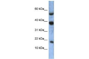 WB Suggested Anti-ATXN7L1 Antibody Titration: 0. (ATXN7L1 antibody  (Middle Region))