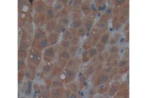 IHC-P analysis of Human Tissue, with DAB staining. (REV1 antibody  (AA 834-976))