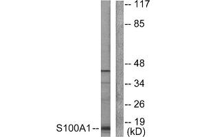 Western Blotting (WB) image for anti-S100 Calcium Binding Protein A1 (S100A1) (N-Term) antibody (ABIN1848767) (S100A1 antibody  (N-Term))