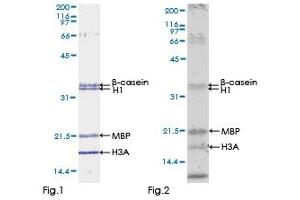 Kinase Activity Assay (KAA) image for Bone Morphogenetic Protein Receptor, Type IB (BMPR1B) (AA 14-502) protein (GST tag) (ABIN1346785)