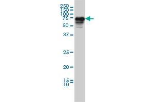CAMKK2 monoclonal antibody (M01), clone 1A11 Western Blot analysis of CAMKK2 expression in IMR-32 .