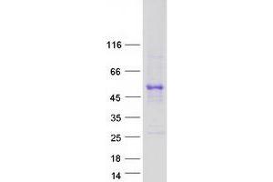 Validation with Western Blot (TAPBP Protein (Transcript Variant 1) (Myc-DYKDDDDK Tag))