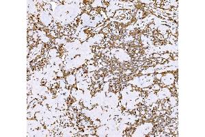 IHC analysis of SND1 using anti-SND1 antibody (ABIN7600525).