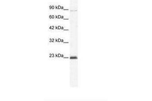 Image no. 1 for anti-Minichromosome Maintenance Deficient 4 (MCM4) (C-Term) antibody (ABIN203262) (MCM4 antibody  (C-Term))