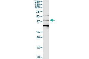 Immunoprecipitation of SERPINB3 transfected lysate using anti-SERPINB3 MaxPab rabbit polyclonal antibody and Protein A Magnetic Bead , and immunoblotted with SERPINB3 purified MaxPab mouse polyclonal antibody (B01P) . (SERPINB3 antibody  (AA 1-390))