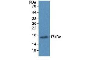 Detection of Recombinant ALOX15, Human using Monoclonal Antibody to Arachidonate-15-Lipoxygenase (ALOX15) (ALOX15 antibody  (AA 170-312))