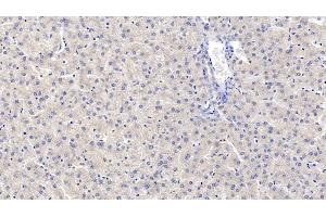 Detection of MAPRE1 in Human Liver Tissue using Monoclonal Antibody to Microtubule Associated Protein RP/EB Family, Member 1 (MAPRE1) (MAPRE1 antibody  (AA 2-268))
