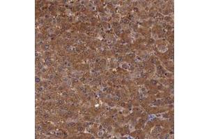 Immunohistochemistry (Formalin/PFA-fixed paraffin-embedded sections) of human liver with PLEK2 polyclonal antibody  shows strong cytoplasmic positivity in hepatocytes.