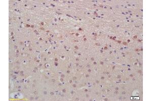 Formalin-fixed and paraffin embedded rat brain labeled with Anti-ANP Polyclonal Antibody, Unconjugated (ABIN676928) at 1:200, followed by conjugation to the secondary antibody and DAB staining