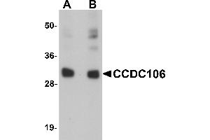 Western Blotting (WB) image for anti-Coiled-Coil Domain Containing 106 (CCDC106) (C-Term) antibody (ABIN1030324) (CCDC106 antibody  (C-Term))