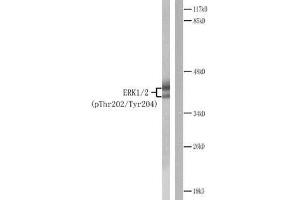 Western blot analysis of extracts from Jurkat cells treated with PMA. (ERK1/2 antibody  (pThr202, pTyr204))