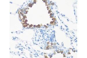 Immunohistochemistry of paraffin-embedded Mouse lung using FGF10 Polyclonal Antibody at dilution of 1:100 (40x lens). (FGF10 antibody)