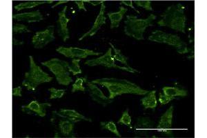 Immunofluorescence (IF) image for anti-Metalloproteinase Inhibitor 2 (TIMP2) (AA 27-220) antibody (ABIN948564)