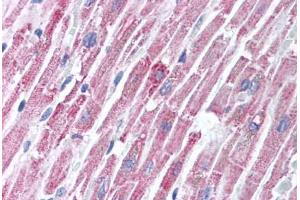 Human Heart (formalin-fixed, paraffin-embedded) stained with TIRAP antibody ABIN213995 at 2 ug/ml followed by biotinylated goat anti-rabbit IgG secondary antibody ABIN481713, alkaline phosphatase-streptavidin and chromogen. (TIRAP antibody  (C-Term))