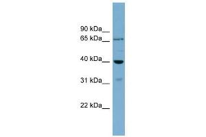 H2AFY2 antibody used at 1 ug/ml to detect target protein.