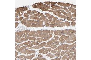 Immunohistochemical staining of human heart muscle with CCDC80 polyclonal antibody  shows moderate cytoplasmic positivity in myocytes at 1:50-1:200 dilution. (CCDC80 antibody)