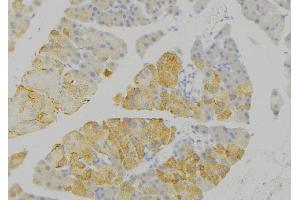 ABIN6276778 at 1/100 staining Human pancreas tissue by IHC-P.
