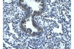 Rabbit Anti-RGS19 Antibody       Paraffin Embedded Tissue:  Human bronchiole epithelium   Cellular Data:  Epithelial cells of renal tubule  Antibody Concentration:   4. (RGS19 antibody  (N-Term))