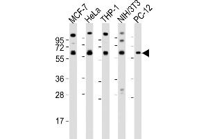 All lanes : Anti-PKM2 antibody at 1:2000 dilution Lane 1: MCF-7 whole cell lysates Lane 2: Hela whole cell lysates Lane 3: THP-1 whole cell lysates Lane 4: NIH/3T3 whole cell lysates Lane 5: PC-12 whole cell lysates Lysates/proteins at 20 μg per lane. (PKM2 antibody  (N-Term))