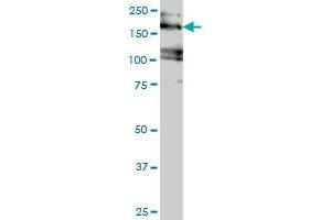 Western Blotting (WB) image for anti-Eukaryotic Translation Initiation Factor 4 gamma 3 (EIF4G3) (AA 1-516) antibody (ABIN599054) (EIF4G3 antibody  (AA 1-516))