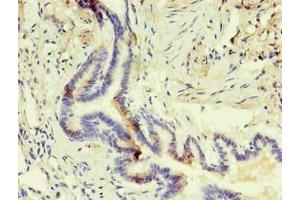 Immunohistochemistry of paraffin-embedded human lung using ABIN7140933 in 30 μg/mL dilute concentrations.