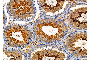 ABIN6265691 and ABIN6276606 at 1/100 staining Mouse testis tissue by IHC-P. (TPM3 antibody  (N-Term))