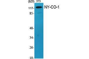 Western Blot (WB) analysis of specific cells using NY-CO-1 Polyclonal Antibody. (NEMF antibody  (C-Term))