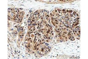 IHC analysis of SDE2 using anti-SDE2 antibody (ABIN7599603). (C1orf55 antibody  (AA 10-447))