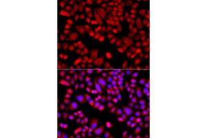 Immunofluorescence analysis of A549 cells using ARPC3 antibody.