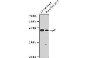Western blot analysis of extracts of various cell lines using p21 Polyclonal Antibody at dilution of 1:1000. (p21 antibody)