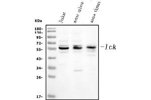 Western blot analysis of Lck using anti-Lck antibody (ABIN3043870). (LCK antibody  (C-Term))