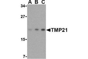 Western blot analysis of TMP21 in mouse brain tissue lysate with this product at (A) 0. (TMED10 antibody  (Center))