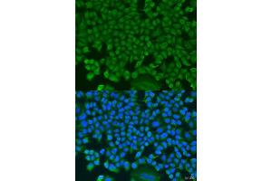 Immunofluorescence analysis of U2OS cells using HS1BP3 antibody. (HS1BP3 antibody  (AA 1-200))