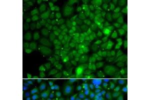 Immunofluorescence analysis of A549 cells using RRAGA Polyclonal Antibody (RRAGA antibody)