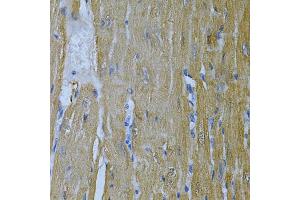 Immunohistochemistry of paraffin-embedded mouse heart using  Antibody (ABIN6127328, ABIN6136696, ABIN6136697 and ABIN6217467) at dilution of 1:100 (40x lens). (Adenylate Kinase 1 antibody  (AA 1-194))