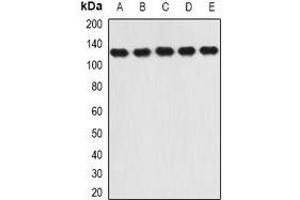 Western blot analysis of RANBP5 expression in SW620 (A), Hela (B), HepG2 (C), mouse heart (D), mouse brain (E) whole cell lysates. (Importin 5 antibody)