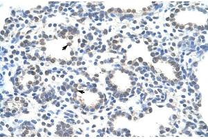 Human Lung; ZRANB2 antibody - middle region in Human Lung cells using Immunohistochemistry (ZNF265 antibody  (Isoform 2, Middle Region))
