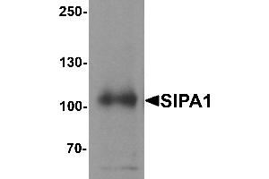 Western blot analysis of SIPA1 in human brain tissue lysate with SIPA1 antibody at 1 µg/mL. (SIPA1 antibody  (N-Term))