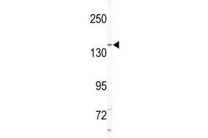 Western blot analysis of NIK antibody and Jurkat lysate. (MAP4K4 antibody  (AA 618-649))