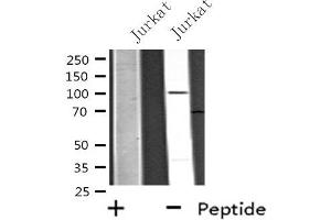 Western blot analysis of extracts from 293 cells, using USP11 antibody.