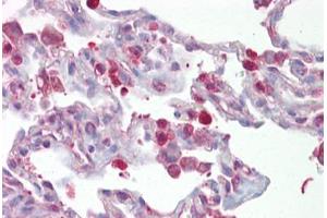 Anti-FOSL1 / FRA1 antibody IHC staining of human lung. (FOSL1 antibody  (AA 143-192))