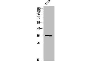 OR5B12 antibody  (Internal Region)