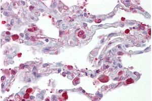 Immunohistochemistry with Lung tissue at an antibody concentration of 5µg/ml using anti-FOSL1 antibody (ARP31378_P050) (FOSL1 antibody  (Middle Region))