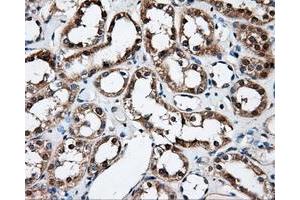 Immunohistochemical staining of paraffin-embedded Kidney tissue using anti-FAHD2Amouse monoclonal antibody. (FAHD2A antibody)